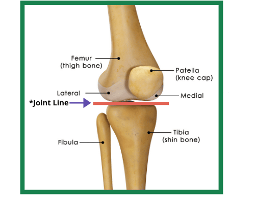 Tenderness at the joint line due to meniscus tear