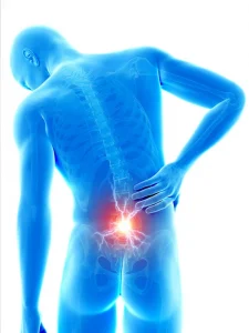 What are the Symptoms of Low Back Pain?