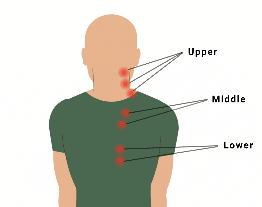 Neck and shoulder Trigger Points