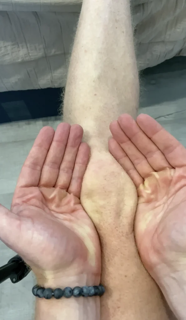 Kneecap stretch know as cupping
