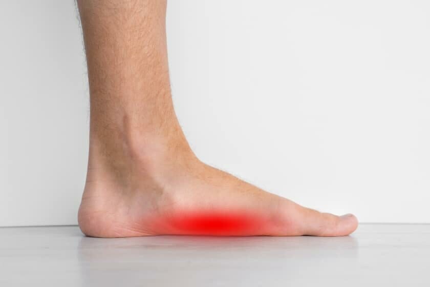 sign of painful flat foot