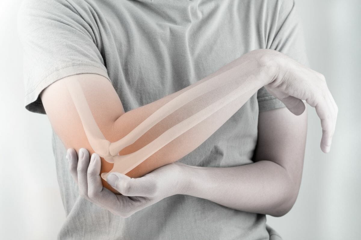 elbow sprain