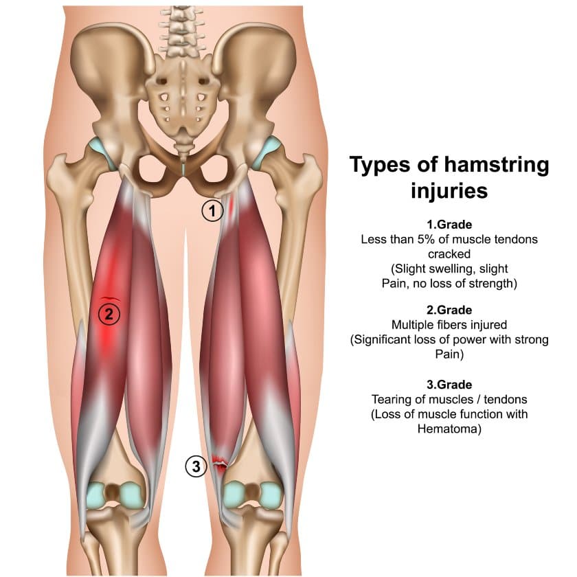 hamstrings muscle anatomy