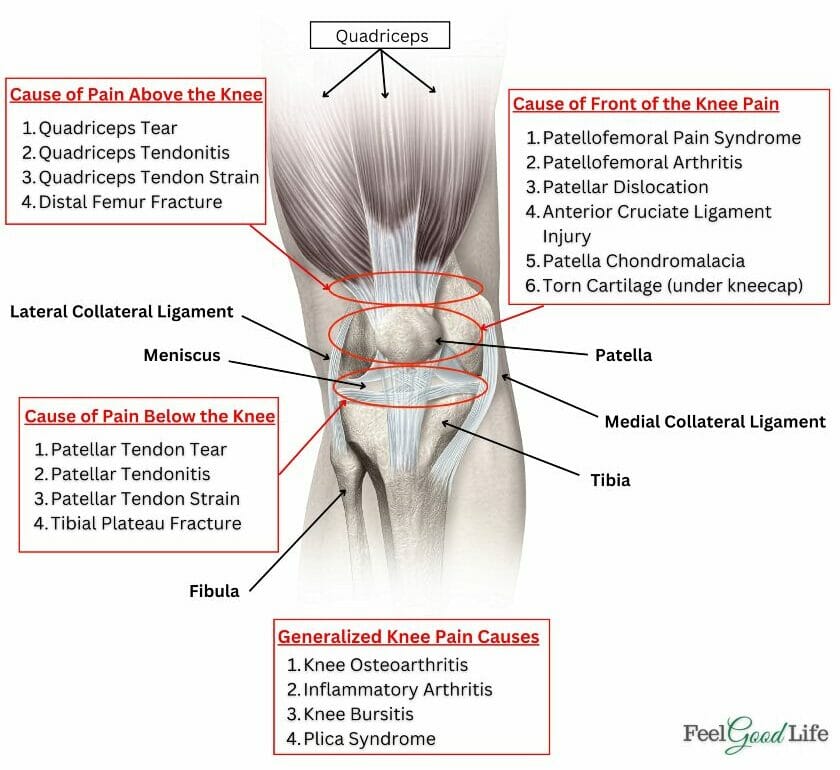 knee pain chart location part 1 e1669304573471