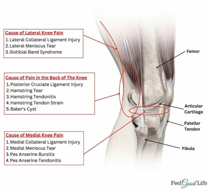knee pain chart location