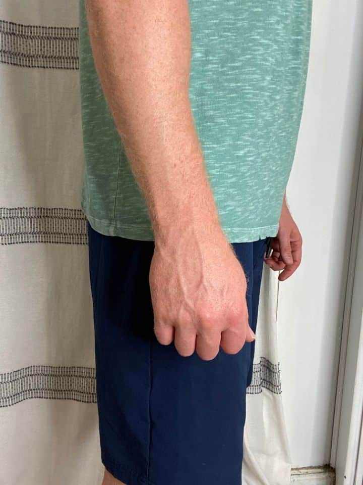 Advanced Wrist Ulnar Deviation step 1