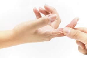 Finger Sprain: Rehab Exercises