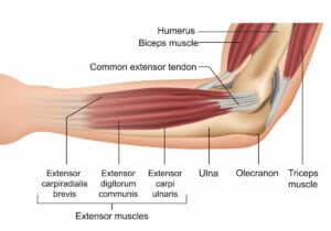 Strengthen elbow ligaments