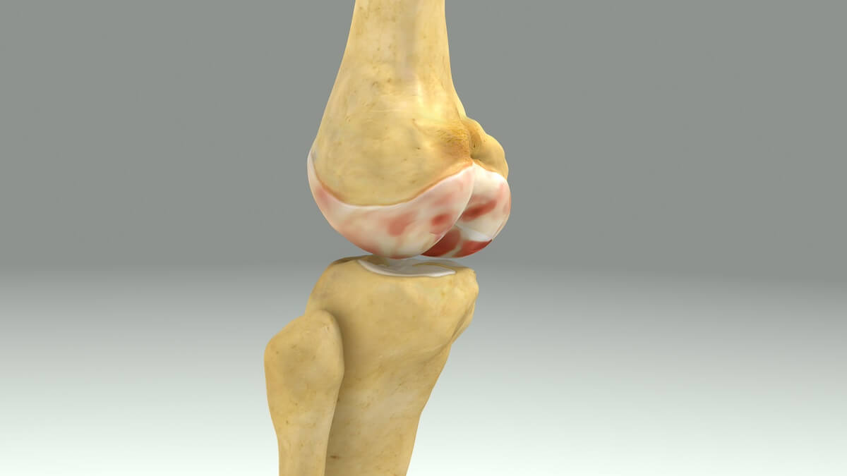 knee cartilage loss exercises