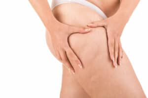 8 Simple Exercises to Help Reduce Cellulite
