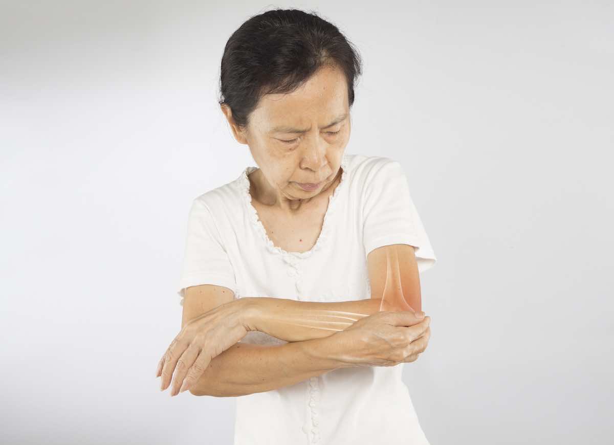 At-Home Exercises for Elbow Rheumatoid Arthritis